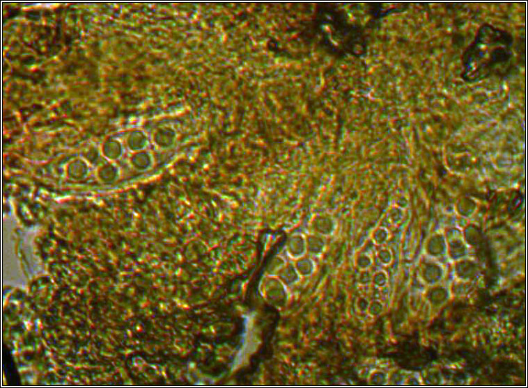 Placynthiella icmalea